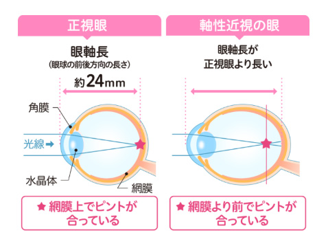 効果と治療の重要性